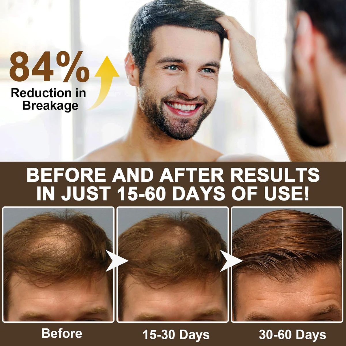 Caffeine Shampoos, Caffeine Shampoo Cleanses the Scalp to Promote Natural Hair Growth Men'S Natural Hair Growth Shampoo and Scalp Tonic for Thinning Hair