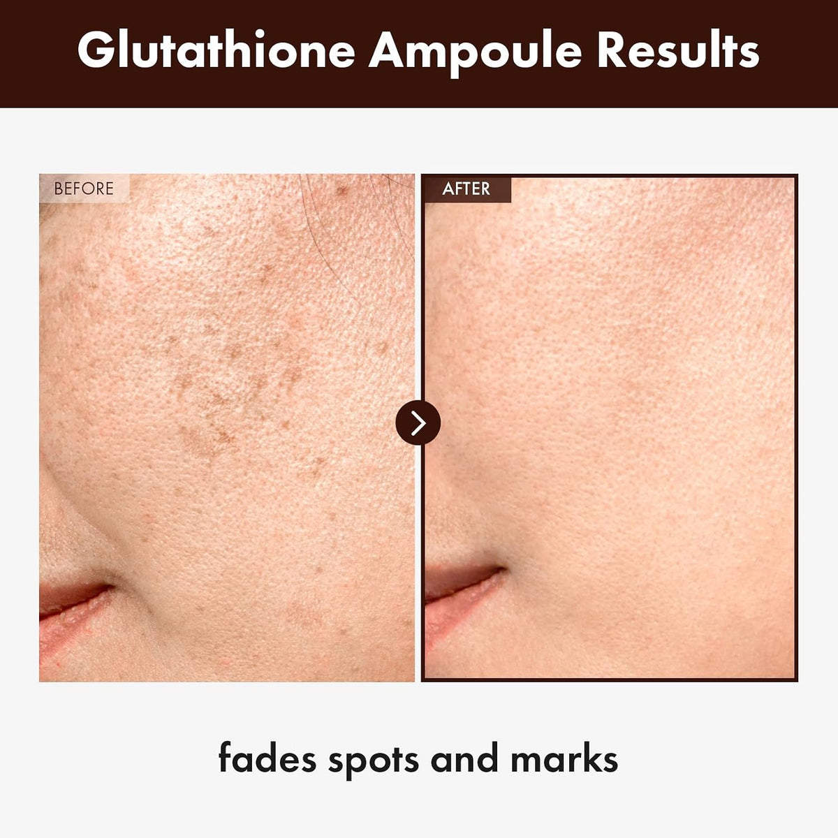 Glutathione 2% Serum, Dark Spots & Elasticity, Radiant Complexion | 2% (20,000Ppm) Glutathione, Niacinamide, Hyaluronic Acid for Dark Spots & Skin Elasticity, Glow, Korean Skincare, 1.01 Fl Oz