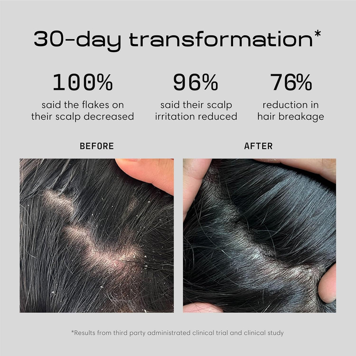 Balancing Shampoo and Restoring Serum - anti Dandruff Shampoo & Serum for Flaky, Itchy, Oily, & Dry Scalp - Nourishes Scalp, Reduces Breakage & Flakes - Color-Safe, Sulfate-Free, Paraben-Free