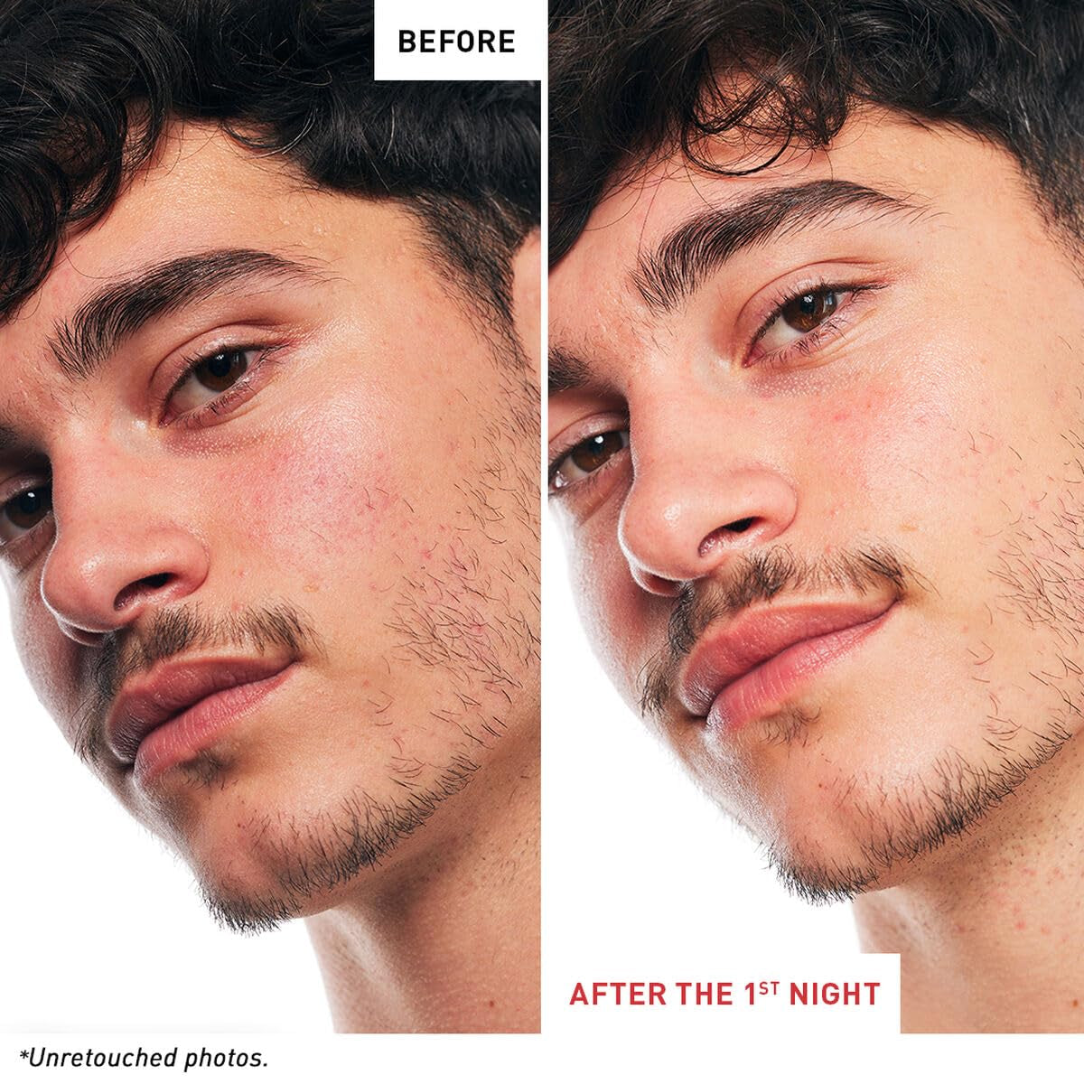 Erborian Multi-Perfecting Night Serum, Oil & Milky Formula, Korean Skincare
