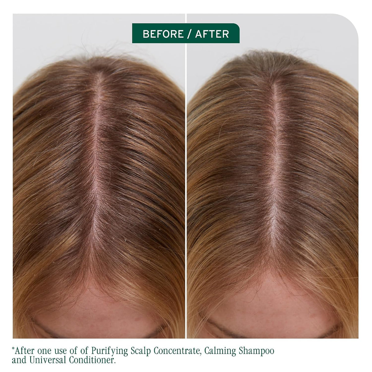 Biolage Scalp Sync Calming Shampoo – for Sensitive Scalps | Fermented Tea Blend, Glycolic Acid, Vegan, Paraben-Free, Gently Cleanses, Hydrates, Soothes