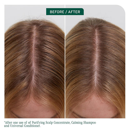 Biolage Scalp Sync Calming Shampoo – for Sensitive Scalps | Fermented Tea Blend, Glycolic Acid, Vegan, Paraben-Free, Gently Cleanses, Hydrates, Soothes