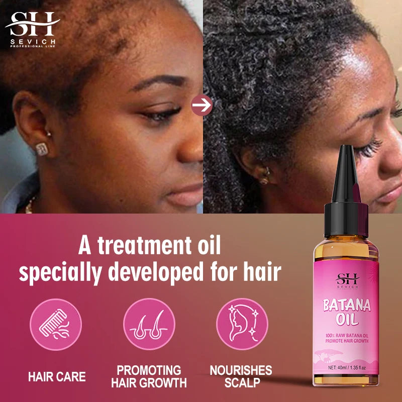 Natural 100% Pure Batana Oil for Hair Growth Butter Hair Mask Traction Alopecia anti Hair Loss Baldness Treatment for Men Women