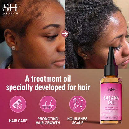 Natural 100% Pure Batana Oil for Hair Growth Butter Hair Mask Traction Alopecia anti Hair Loss Baldness Treatment for Men Women