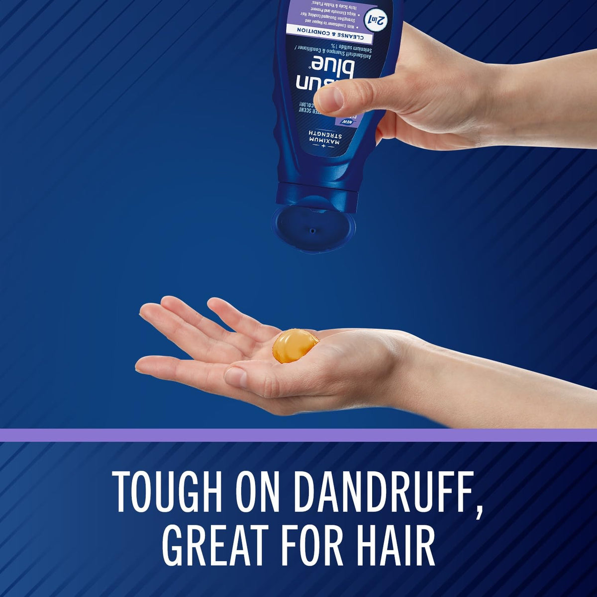 2-In-1 Antidandruff Shampoo & Conditioner, Maximum Strength 2-In-1 Treatment with Selenium Sulfide, 11 Fl. Oz.