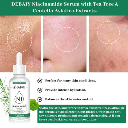 5% Niacinamide Serum with 4% Tea Tree & Centella Asiatica Extracts Soothing Facial Serum (3 Pack 1Fl.Oz|30Ml)