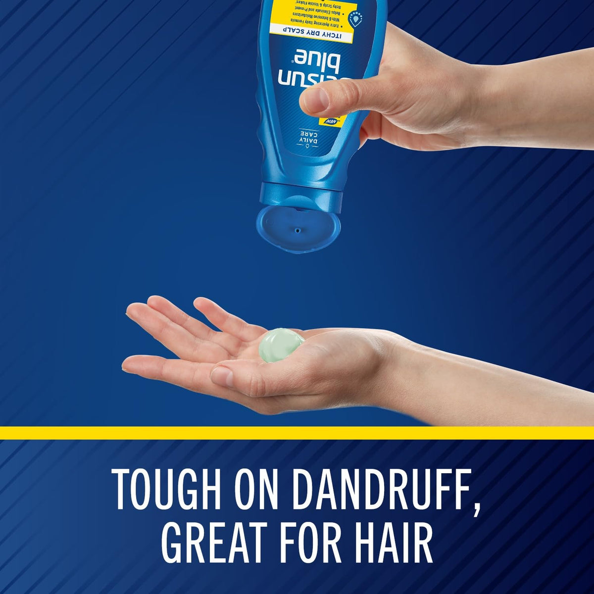 Itchy Dry Scalp Anti-Dandruff Shampoo, 11 Fl. Oz., Extra-Hydrating Formula, Pyrithione Zinc 1%